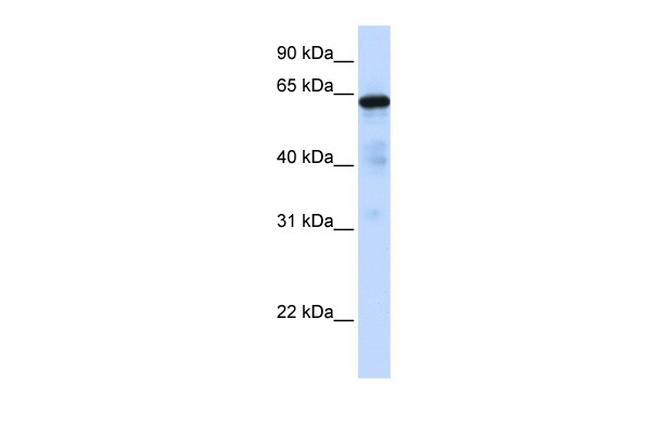 FOXN4 Antibody in Western Blot (WB)