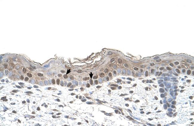 beta-Arrestin 2 Antibody in Immunohistochemistry (IHC)