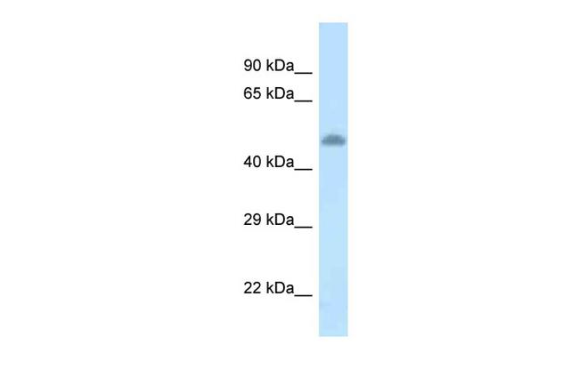 TAT Antibody in Western Blot (WB)