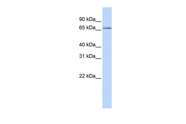 TRMT5 Antibody in Western Blot (WB)