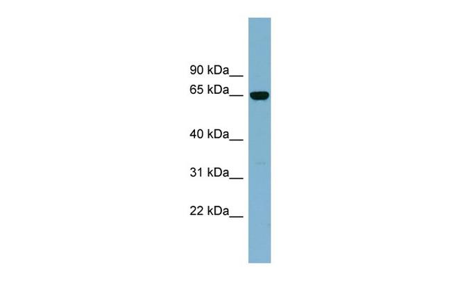 IL-22 Receptor alpha Antibody in Western Blot (WB)