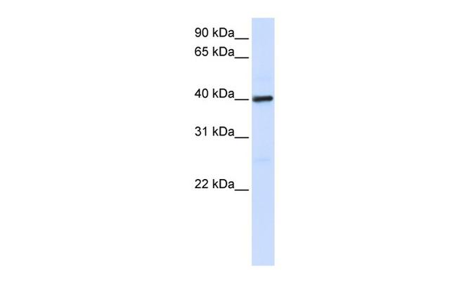 MOSC1 Antibody in Western Blot (WB)