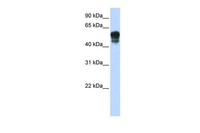 SPNS1 Antibody in Western Blot (WB)