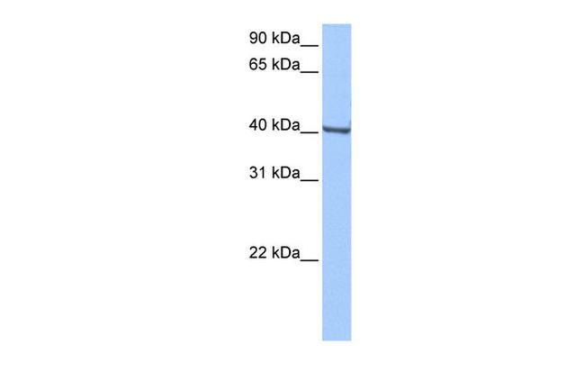 GBX1 Antibody in Western Blot (WB)