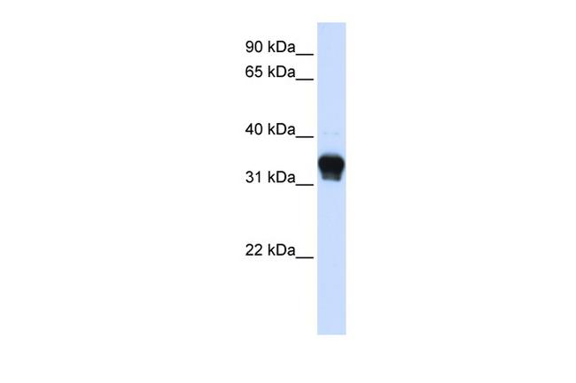 CK1 alpha Antibody in Western Blot (WB)