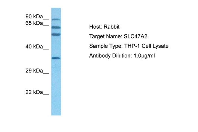 SLC47A2 Antibody in Western Blot (WB)