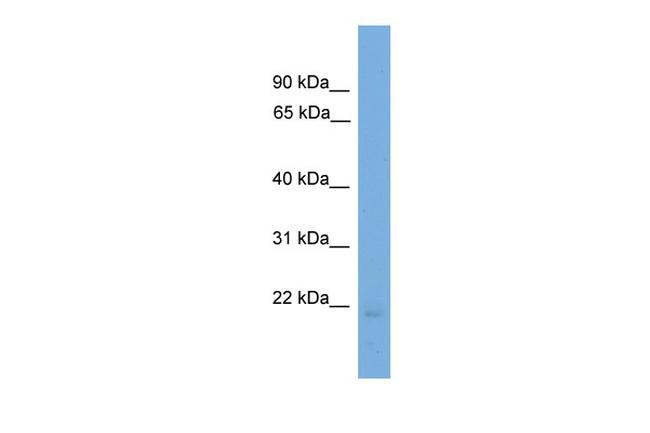 Endothelin 2 Antibody in Western Blot (WB)