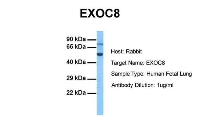 EXOC8 Antibody in Western Blot (WB)