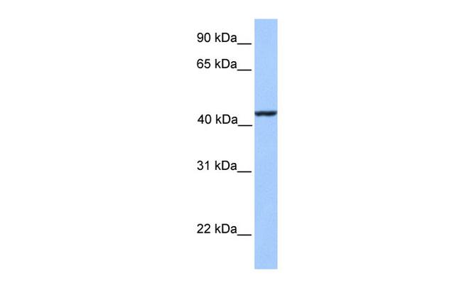 KLC3 Antibody in Western Blot (WB)