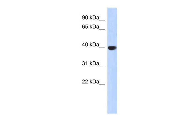 Aurora C Antibody in Western Blot (WB)