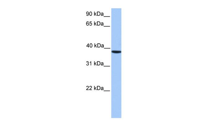 CK2 alpha-2 Antibody in Western Blot (WB)