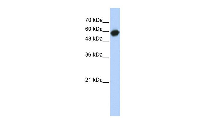 LRRC6 Antibody in Western Blot (WB)