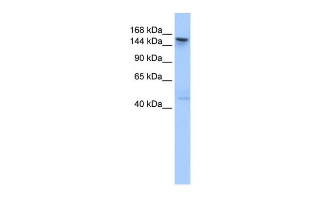 TEX14 Antibody in Western Blot (WB)