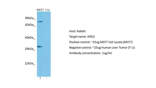 Arginase 2 Antibody in Western Blot (WB)