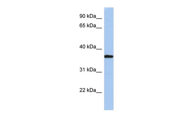 LDLRAP1 Antibody in Western Blot (WB)