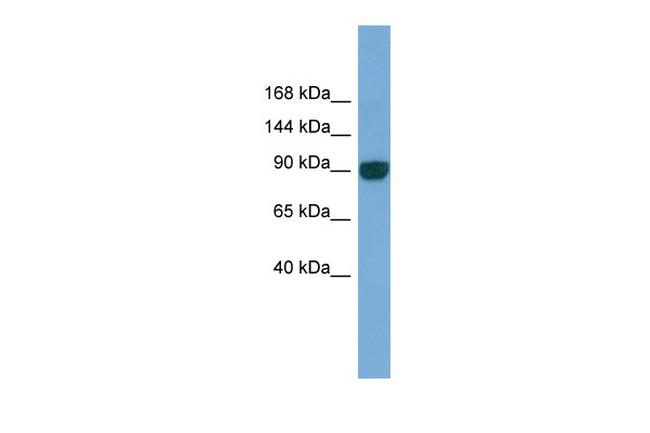 UNC45A Antibody in Western Blot (WB)