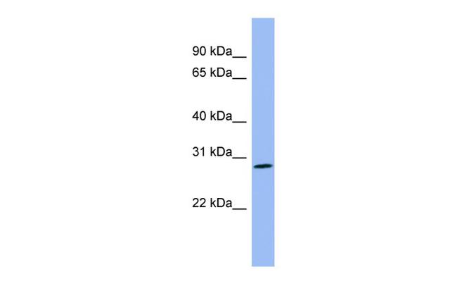 PENK Antibody in Western Blot (WB)