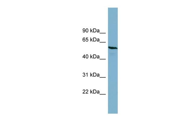 PGM3 Antibody in Western Blot (WB)