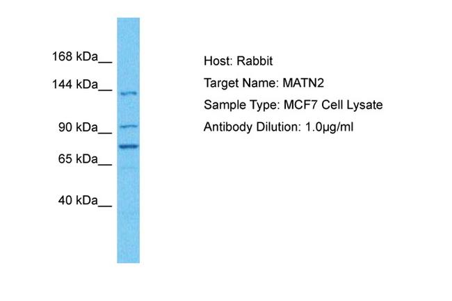 MATN2 Antibody in Western Blot (WB)