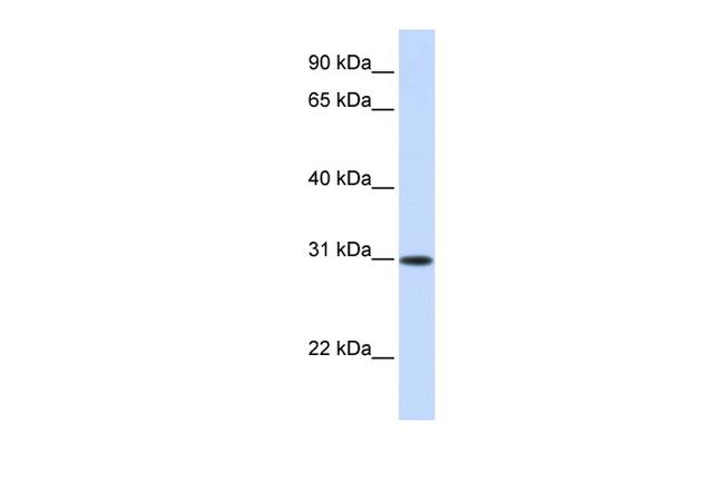 ATF5 Antibody in Western Blot (WB)