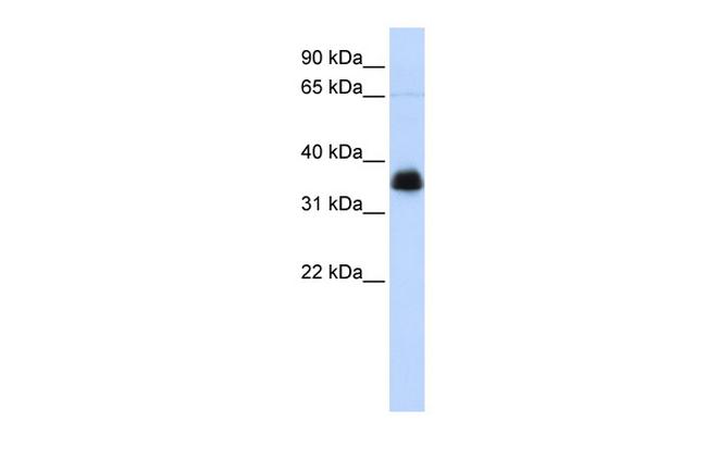 AIP Antibody in Western Blot (WB)