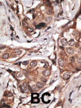 HTRA1 Antibody in Immunohistochemistry (Paraffin) (IHC (P))