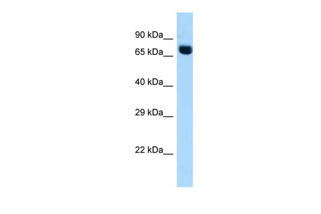 ACSS2 Antibody in Western Blot (WB)