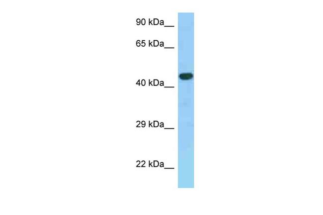 GPR30 Antibody in Western Blot (WB)