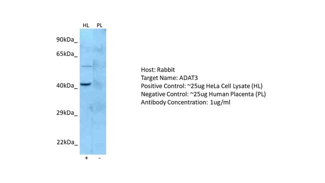 ADAT3 Antibody in Western Blot (WB)