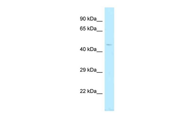 TBC1D20 Antibody in Western Blot (WB)