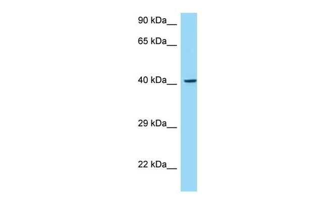 MAdCAM1 Antibody in Western Blot (WB)