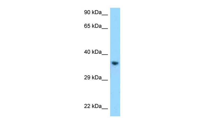 KIR2DL1 Antibody in Western Blot (WB)