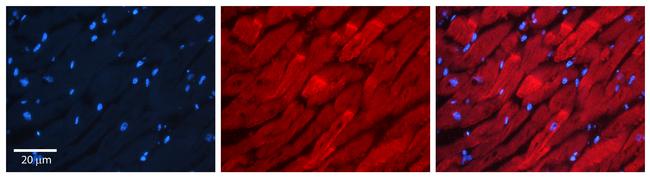 RAB11A Antibody in Immunohistochemistry (Paraffin) (IHC (P))