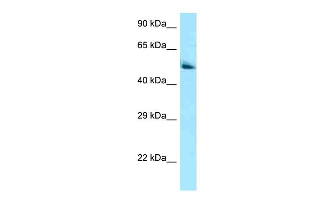 PANK2 Antibody in Western Blot (WB)