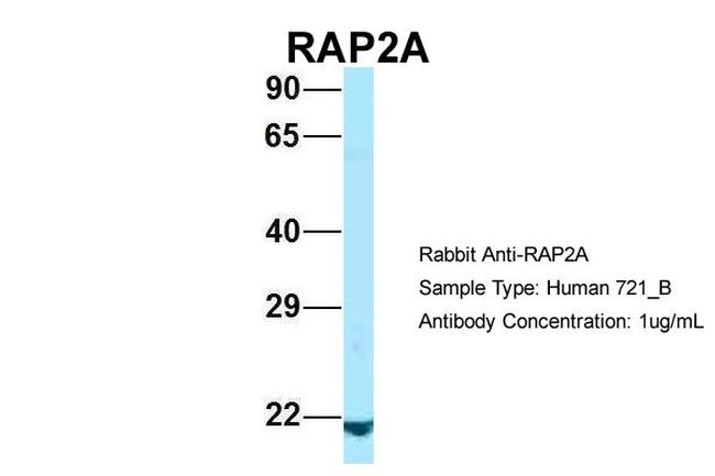 RAP2A Antibody in Western Blot (WB)