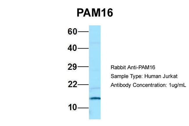 CORO7-PAM16 Antibody in Western Blot (WB)