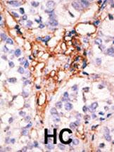 APOBEC3G Antibody in Immunohistochemistry (Paraffin) (IHC (P))