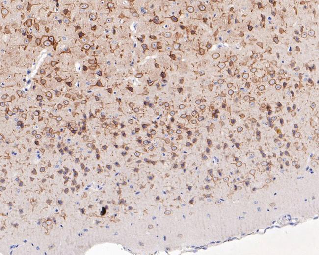 KCNB1 Antibody in Immunohistochemistry (Paraffin) (IHC (P))