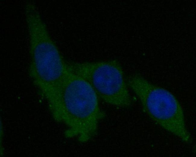 Syntrophin alpha-1 Antibody in Immunocytochemistry (ICC/IF)