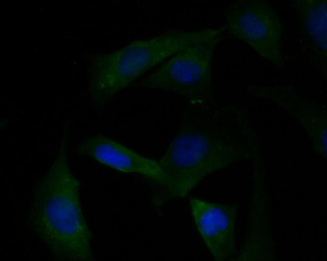 KCNK18 Antibody in Immunocytochemistry (ICC/IF)