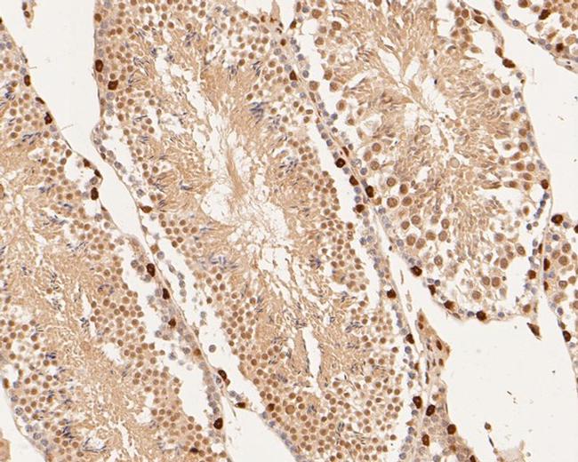 DUX4 Antibody in Immunohistochemistry (Paraffin) (IHC (P))