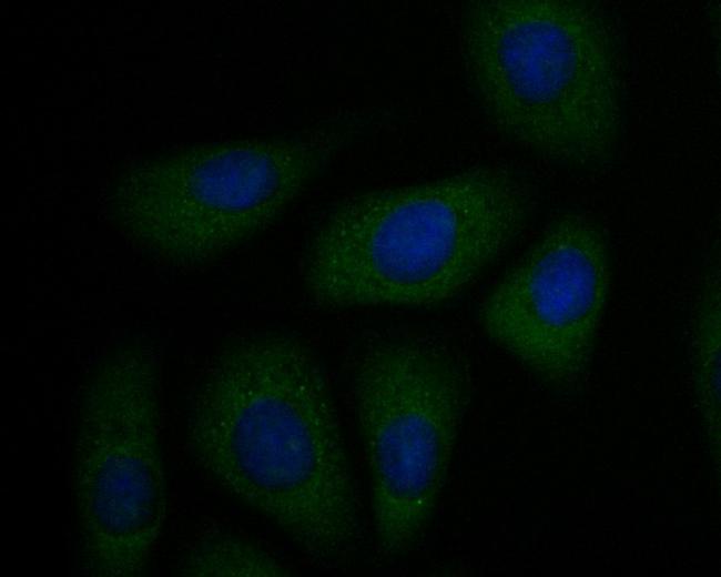 P2X1 Antibody in Immunocytochemistry (ICC/IF)