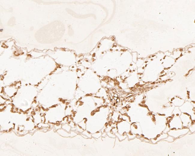 HDG11 Antibody in Immunohistochemistry (Paraffin) (IHC (P))