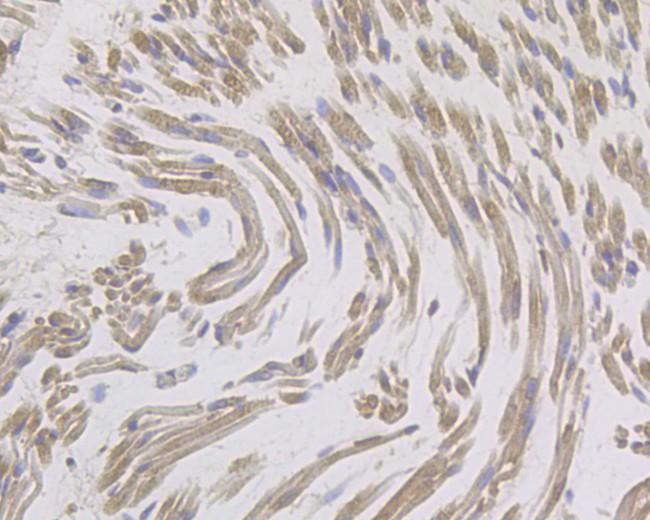 IL8 Antibody in Immunohistochemistry (Paraffin) (IHC (P))