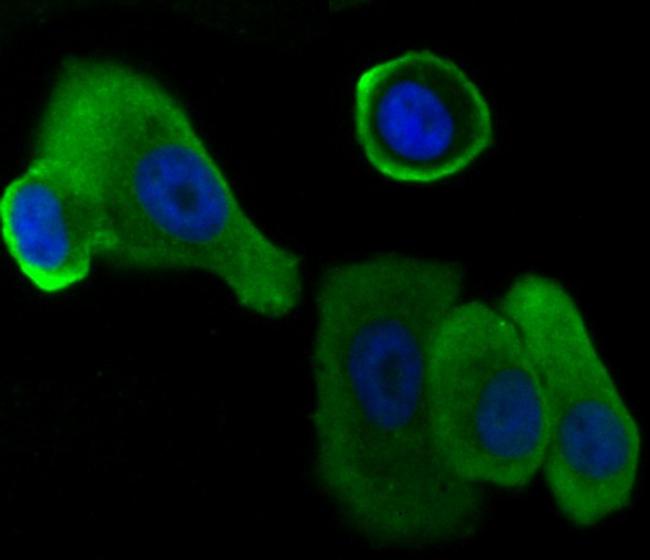 alpha Dystroglycan Antibody in Immunocytochemistry (ICC/IF)