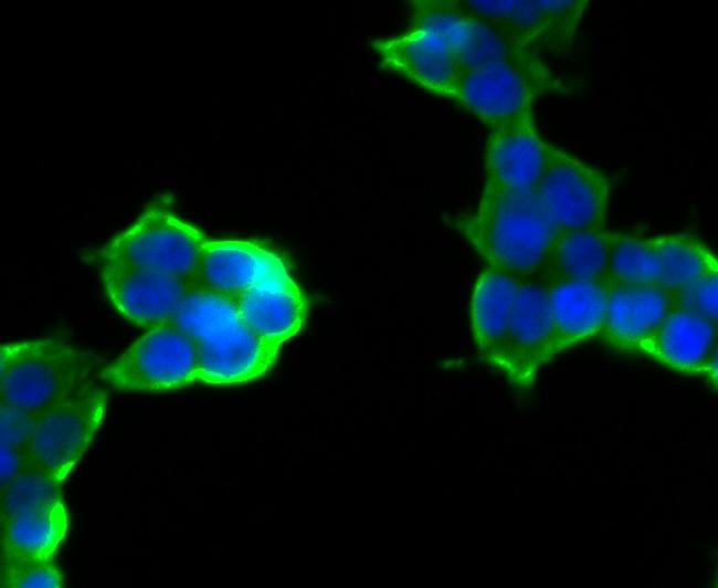 CD35 Antibody in Immunocytochemistry (ICC/IF)