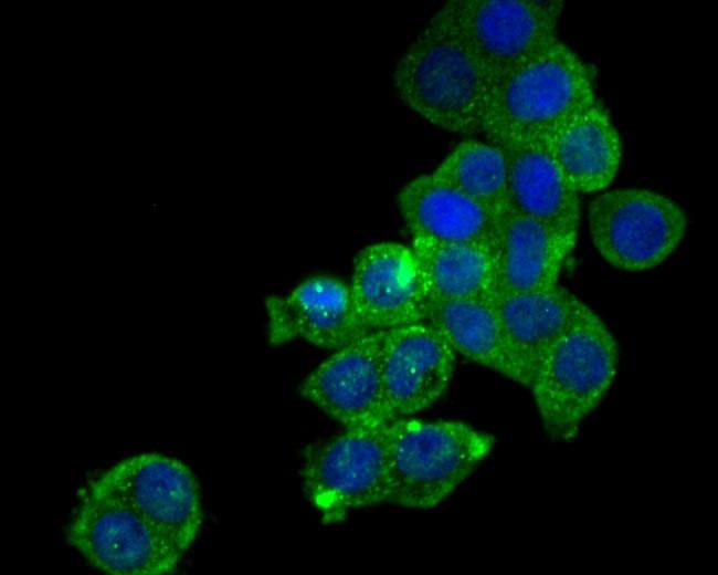 SDF1 Antibody in Immunocytochemistry (ICC/IF)