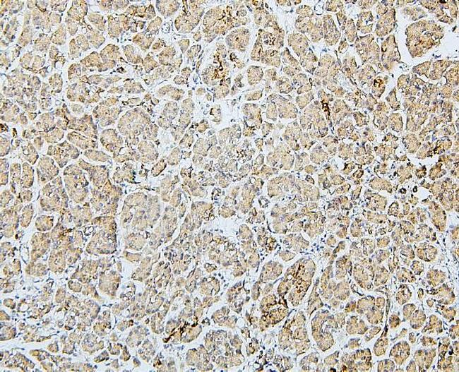 MTR Antibody in Immunohistochemistry (Paraffin) (IHC (P))