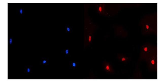 NUP214 Antibody in Immunocytochemistry (ICC/IF)