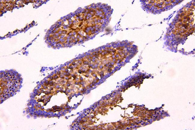 ACACB Antibody in Immunohistochemistry (Paraffin) (IHC (P))